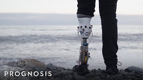 Prognosis