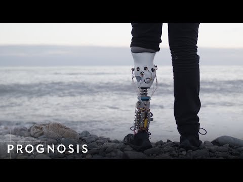 Prognosis - YouTube