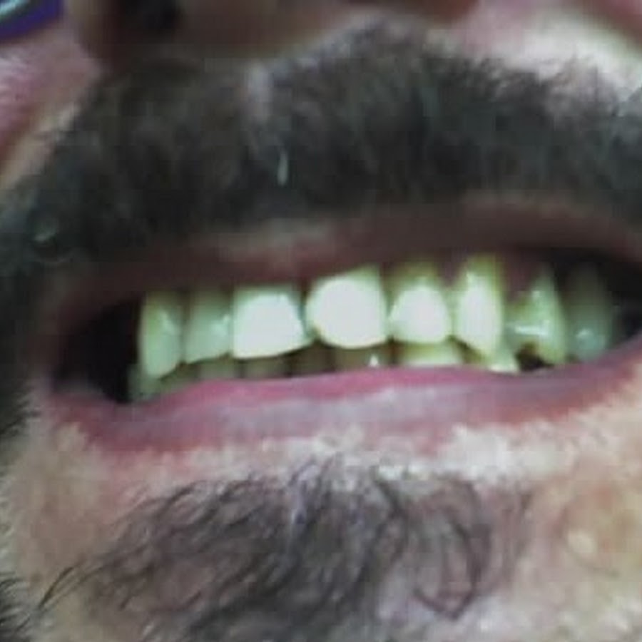 João Couto Teixeira